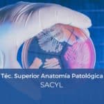 Oposición Técnico Superior Anatomía Patológica SACYL